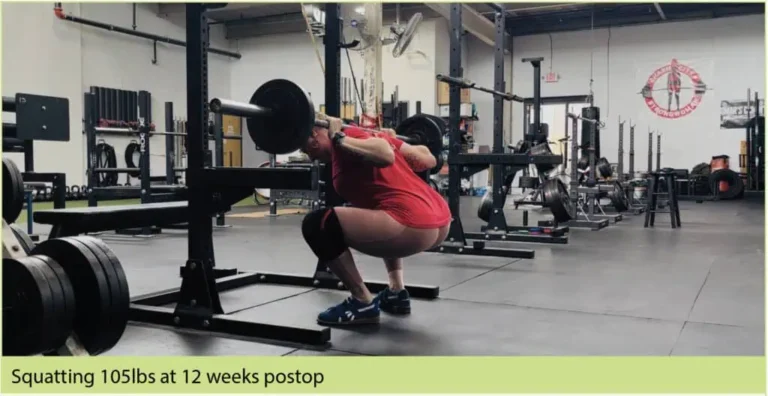 Coach Emily at 12 weeks postop