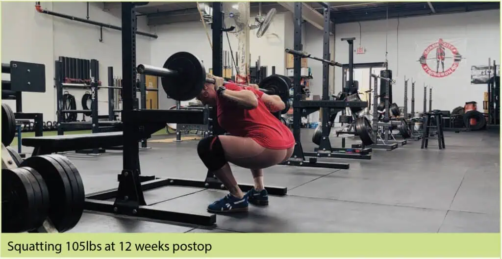 Coach Emily at 12 weeks postop